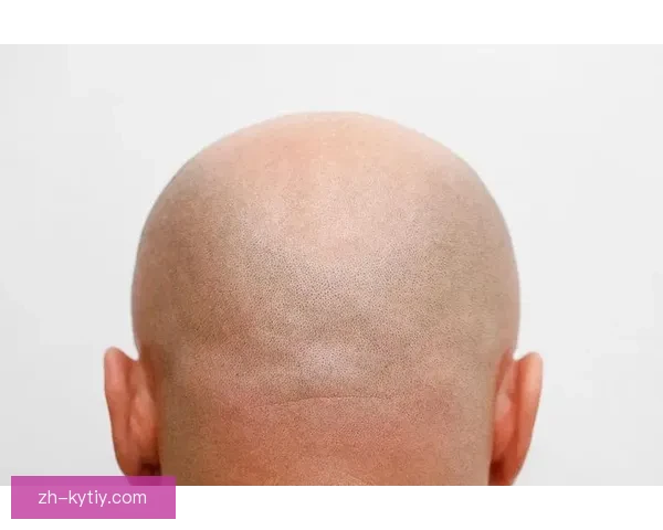 剃光头的背后理由大揭秘 剃光头的背后理由大揭秘